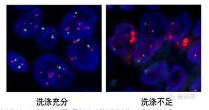 荧光原位杂交(FISH)样本处理标准方案系列(一)——常规石蜡包埋组织切片