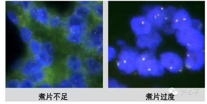 荧光原位杂交(FISH)样本处理标准方案系列(一)——常规石蜡包埋组织切片