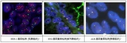 荧光原位杂交(FISH)样本处理标准方案系列(一)——常规石蜡包埋组织切片